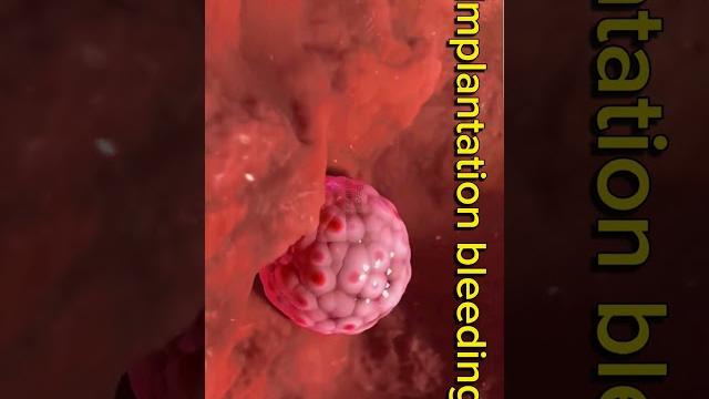 Implantation bleeding || pregnancy loss #shorts #pregnancy Implantation bleeding || pregnancy loss #shorts #pregnancy