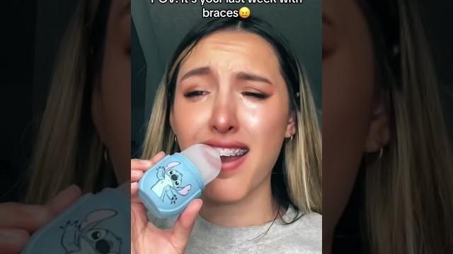 So much painnnn #autumnmonique #braces #youtubeshorts So much painnnn #autumnmonique #braces #youtubeshorts