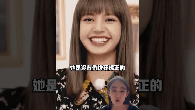 Blackpink jennie vs lisa誰的笑容贏#牙齒矯正 Blackpink jennie vs lisa誰的笑容贏#牙齒矯正