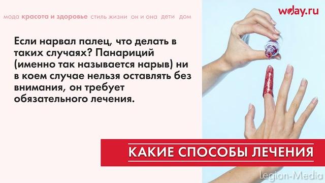 Что делать, если нарывает палец Что делать, если нарывает палец