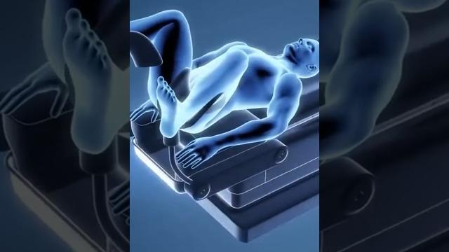 3d animation of hemorrhoidoplasty procedure. #shorts 3d animation of hemorrhoidoplasty procedure. #shorts