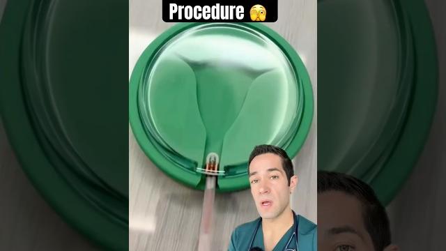 How doctors place an iud How doctors place an iud