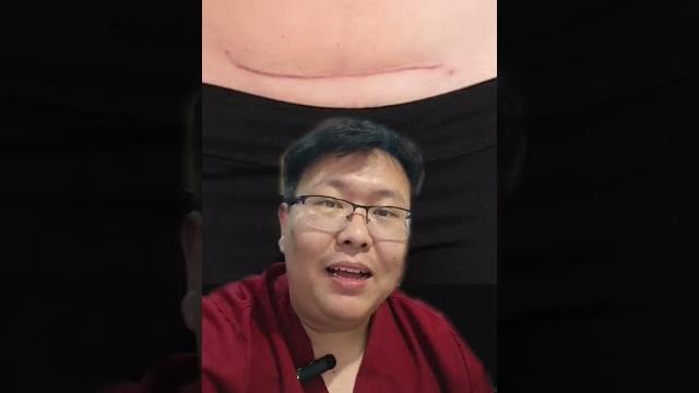 Sesar uda lama tapi luka masih sakit? kenapa ya? #shorts Sesar uda lama tapi luka masih sakit? kenapa ya? #shorts