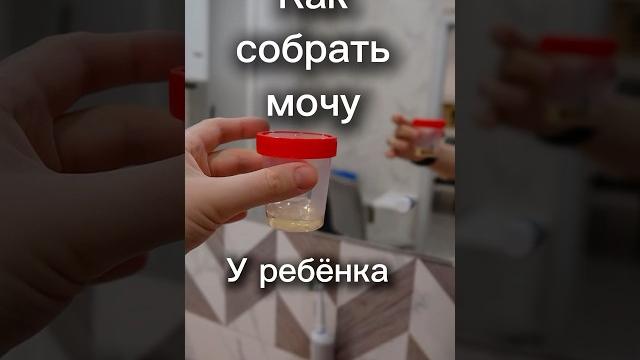 Как собрать анализ мочи у взрослого ребёнка. Как собрать анализ мочи у взрослого ребёнка.
