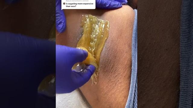 Sugaring vs waxing: waxing underarm using diy sugar wax #shorts Sugaring vs waxing: waxing underarm using diy sugar wax #shorts