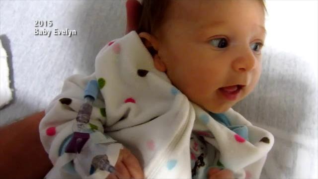 Gene therapy for sma type 1: evelyn's story Gene therapy for sma type 1: evelyn's story