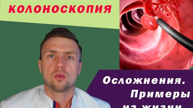 Колоноскопия. осложнения. примеры. Колоноскопия. осложнения. примеры.