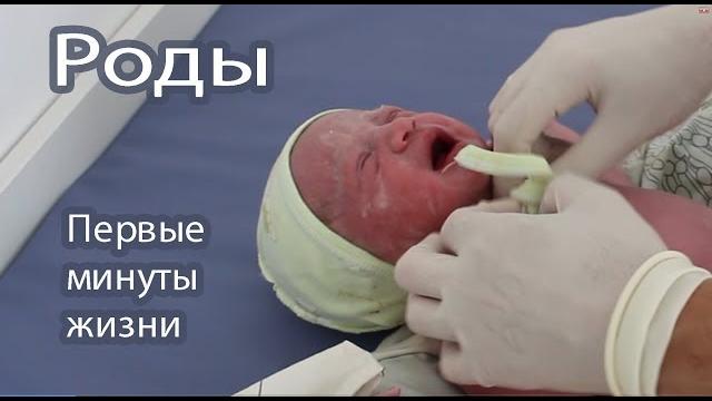 Роды. первые минуты и дни жизни алисы Роды. первые минуты и дни жизни алисы