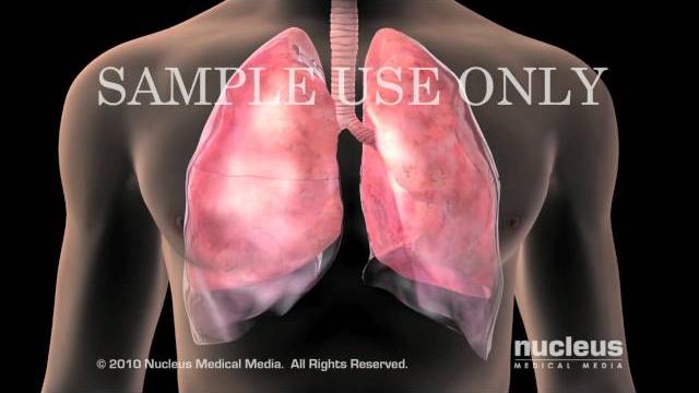 Lung anatomy Lung anatomy