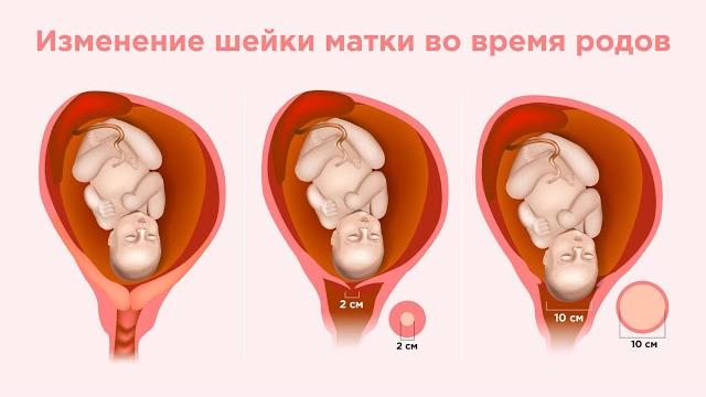 Шейка ерте ашылуы Шейка ерте ашылуы