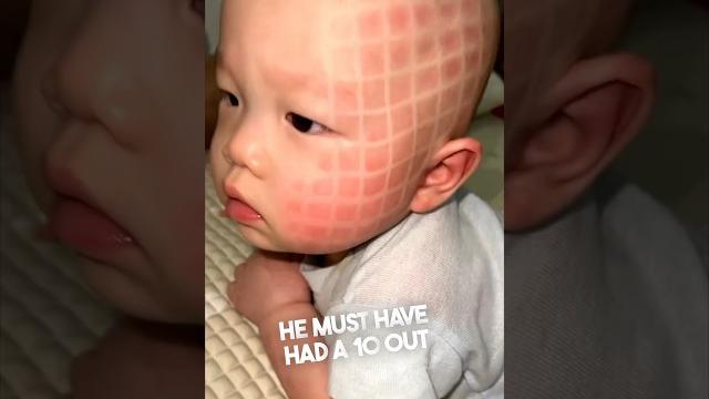 This baby looked completely different after a nap This baby looked completely different after a nap