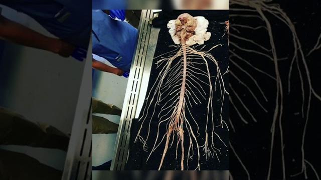 Real nervous system #anatomy #human #body Real nervous system #anatomy #human #body