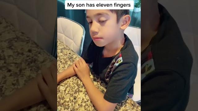 My son has 11 fingers!! My son has 11 fingers!!