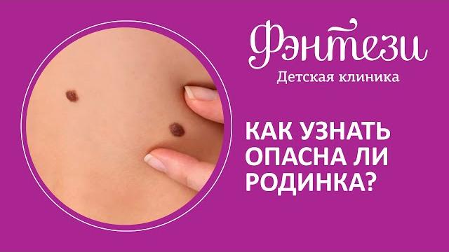 Как узнать опасна ли родинка Как узнать опасна ли родинка