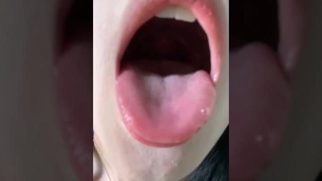 【易直播】【胆胆】口腔检查 深夜痛! 【易直播】【胆胆】口腔检查 深夜痛!