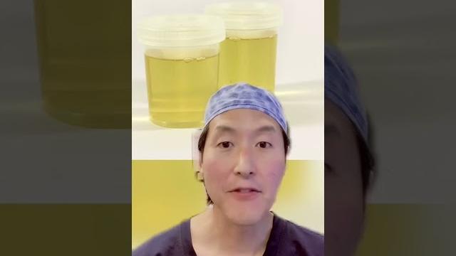 What happens if you drink pee? urine therapy?!?! #shorts What happens if you drink pee? urine therapy?!?! #shorts