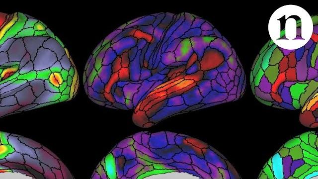 The ultimate brain map The ultimate brain map