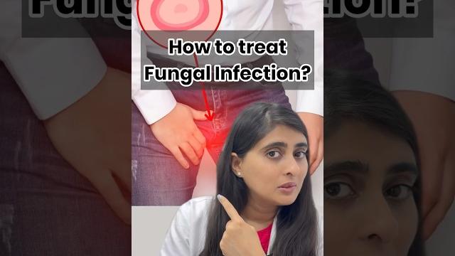 Fungal infection on skin | ointment for fungal infection | fungal infection in private parts Fungal infection on skin | ointment for fungal infection | fungal infection in private parts
