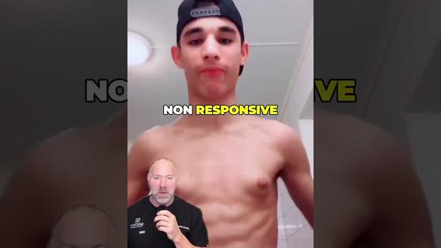 Gynecomastia isn’t about weight #shorts Gynecomastia isn’t about weight #shorts