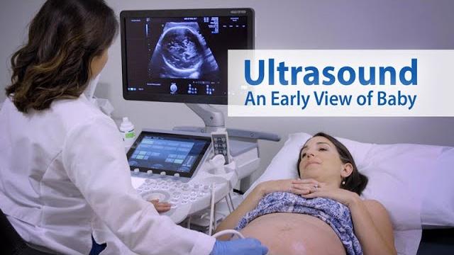Ultrasound: an early view of baby Ultrasound: an early view of baby
