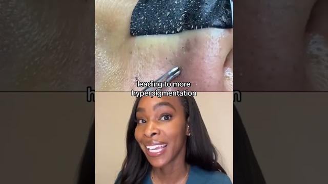 Are pore strips really effective? dermatologist's pov Are pore strips really effective? dermatologist's pov