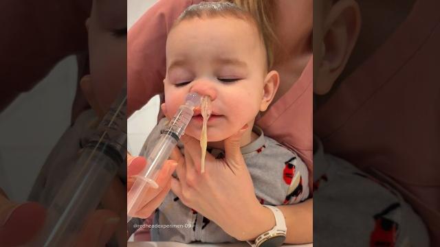 Too much mucus coming out of baby's nose #shorts #trending Too much mucus coming out of baby's nose #shorts #trending