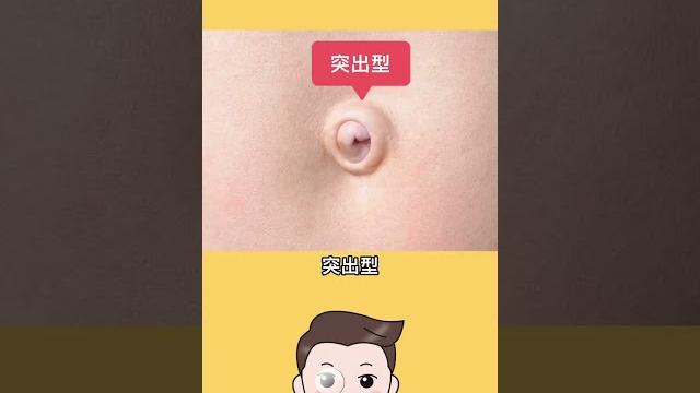 快來看看你的肚臍眼是什麼形狀? #冷知识 #科普 #涨知识 #shorts 快來看看你的肚臍眼是什麼形狀? #冷知识 #科普 #涨知识 #shorts