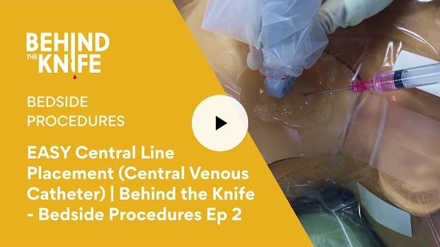 Easy central line placement (central venous catheter) | behind the knife - bedside procedures ep 2 Easy central line placement (central venous catheter) | behind the knife - bedside procedures ep 2