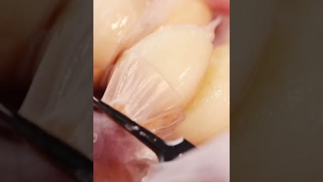 快艾特你喜欢的博主挑战吧,徒手剥大蒜原来这么解压#糖蒜 快艾特你喜欢的博主挑战吧,徒手剥大蒜原来这么解压#糖蒜