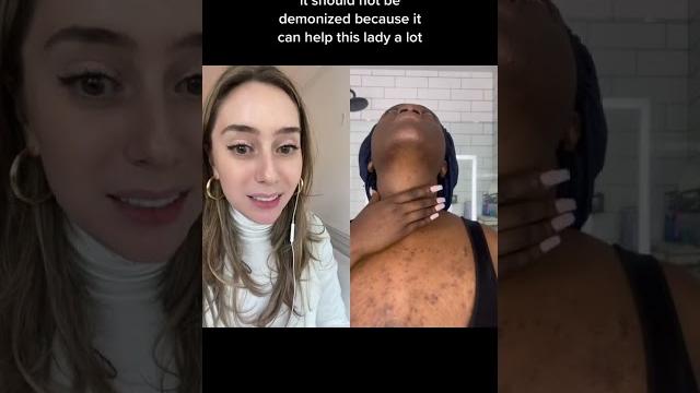 Post inflammatory hyperpigmentation: top ingredients #shorts Post inflammatory hyperpigmentation: top ingredients #shorts