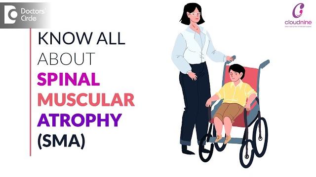 Spinal muscular atrophy (sma)syndrome - dr. seema gaonkar of cloudnine hospitals | doctors' circle Spinal muscular atrophy (sma)syndrome - dr. seema gaonkar of cloudnine hospitals | doctors' circle