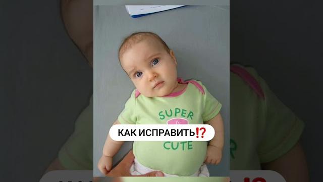 ️кривошея️ ️кривошея️