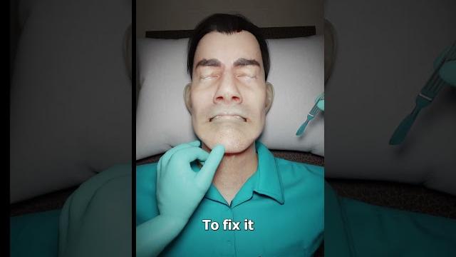 How an elongated uvula is fixed How an elongated uvula is fixed