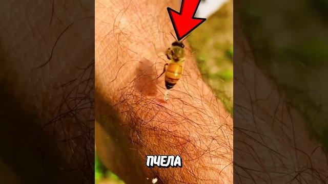Что делать если укусила пчела? Что делать если укусила пчела?