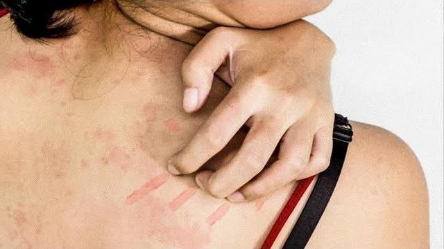 Что делать, если чешиться тело, без видимых причин. Что делать, если чешиться тело, без видимых причин.