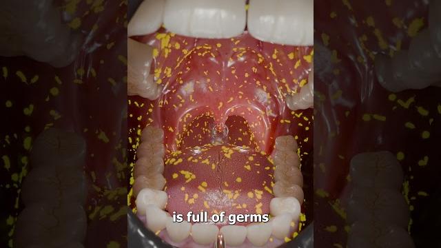 Why you shouldn't pierce your uvula Why you shouldn't pierce your uvula