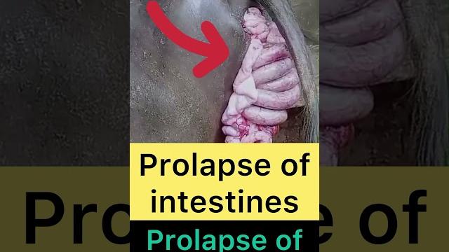 Prolapse of intestines l dr umar khan Prolapse of intestines l dr umar khan
