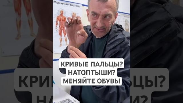 Почему пальцы искривились и стали молоткообразными? #плоскостопие #кривыепальцы #натоптыши #вальгус Почему пальцы искривились и стали молоткообразными? #плоскостопие #кривыепальцы #натоптыши #вальгус