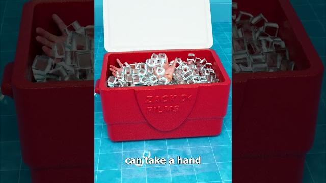 How a hand transplant works How a hand transplant works