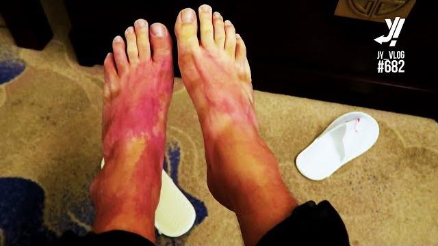 Dead feet Dead feet