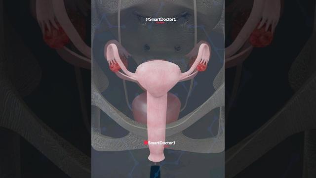 Uterus & ovary | like you've never seen it before. ️ Uterus & ovary | like you've never seen it before. ️