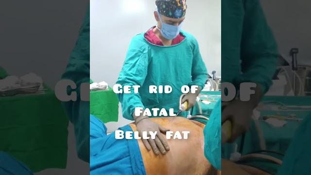Get rid of fatal belly fat with liposuction in pune Get rid of fatal belly fat with liposuction in pune
