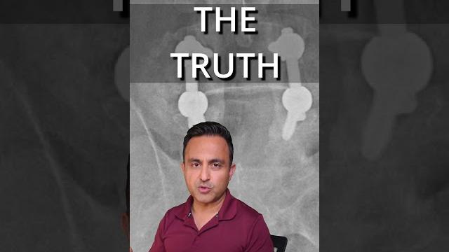 Spine-surgery truth #truth #backpain Spine-surgery truth #truth #backpain