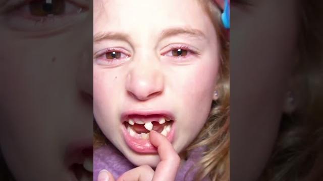Giorgia ha paura di staccarsi il dente da sola e papà salvo l'aiuta! #salvoegiorgia #shorts Giorgia ha paura di staccarsi il dente da sola e papà salvo l'aiuta! #salvoegiorgia #shorts