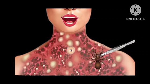 Critical opretion ntr asmr Critical opretion ntr asmr