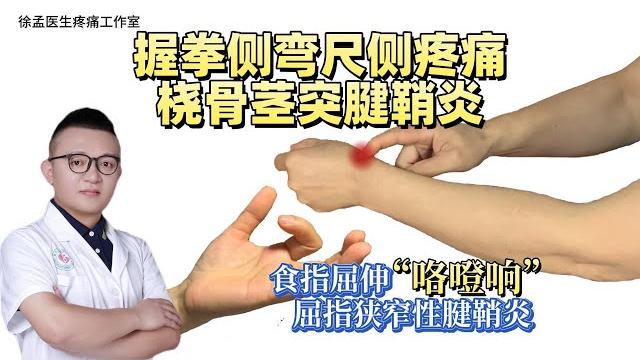 握拳侧弯尺侧疼痛、桡骨茎突狭窄性腱鞘炎、食指屈伸弹响 握拳侧弯尺侧疼痛、桡骨茎突狭窄性腱鞘炎、食指屈伸弹响