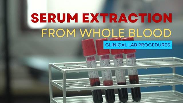 Serum extraction from whole blood Serum extraction from whole blood