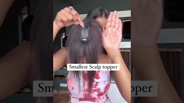 Get instant solution for scanty hairline with @hairoriginals scalp topper!!!#viral #hairoriginals Get instant solution for scanty hairline with @hairoriginals scalp topper!!!#viral #hairoriginals