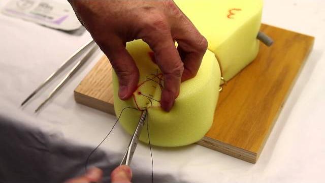 2nd degree perineal repair demonstration 2nd degree perineal repair demonstration