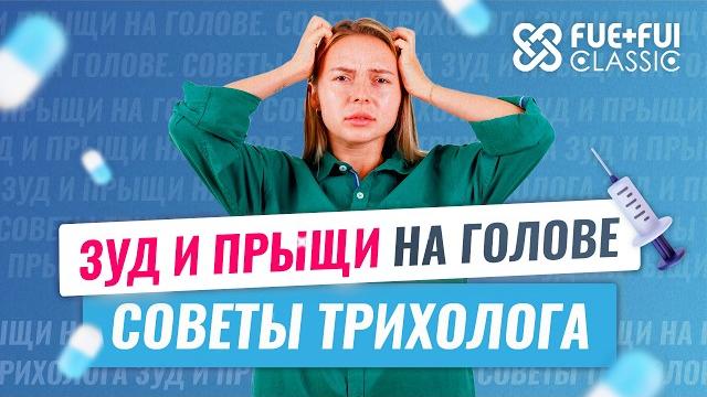 Чешется голова? нужно к трихологу! #облысение #трихолог #алопеция #зуд #уходзаволосами #доктор Чешется голова? нужно к трихологу! #облысение #трихолог #алопеция #зуд #уходзаволосами #доктор